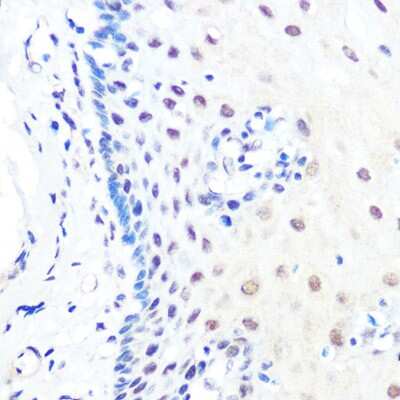 Immunohistochemistry-Paraffin: KLF4 Antibody (7B7U1) [NBP3-15469]