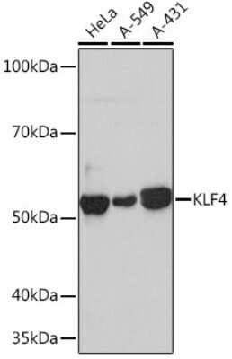 Western Blot: KLF4 Antibody (7B7U1) [NBP3-15469]