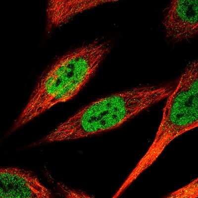 Immunocytochemistry/ Immunofluorescence: KLF4 Antibody (CL5782) [NBP2-61426]