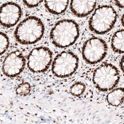 Immunohistochemistry-Paraffin: KLF4 Antibody (CL5782) [NBP2-61426]