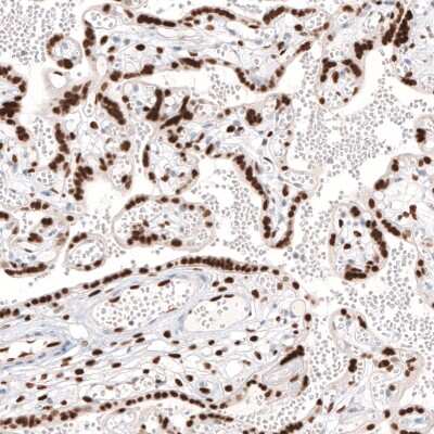 Immunohistochemistry-Paraffin: KLF4 Antibody (CL5782) [NBP2-61426]