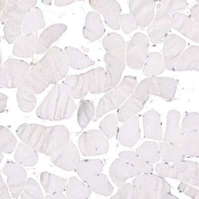 Immunohistochemistry-Paraffin: KLF4 Antibody (CL5782) [NBP2-61426]
