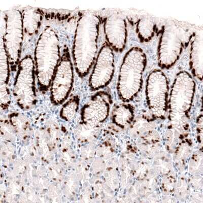 Immunohistochemistry-Paraffin: KLF4 Antibody (CL5785) [NBP2-61427]