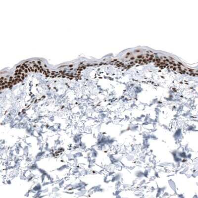 Immunohistochemistry-Paraffin: KLF4 Antibody (CL5785) [NBP2-61427]