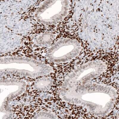 Immunohistochemistry-Paraffin: KLF4 Antibody (CL5785) [NBP2-61427]