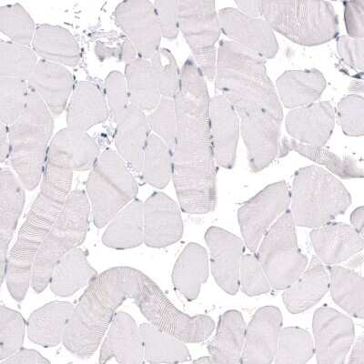 Immunohistochemistry-Paraffin: KLF4 Antibody (CL5785) [NBP2-61427]