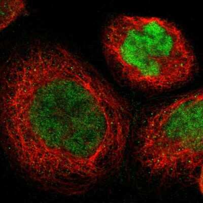 Immunocytochemistry/ Immunofluorescence: KLF4 Antibody [NBP1-83940]