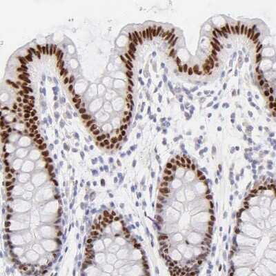 Immunohistochemistry-Paraffin: KLF4 Antibody [NBP1-83940]