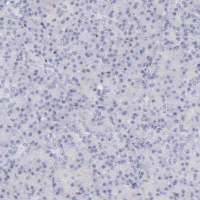Immunohistochemistry-Paraffin: KLF4 Antibody [NBP1-83940]
