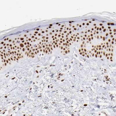 Immunohistochemistry-Paraffin: KLF4 Antibody [NBP1-83940]