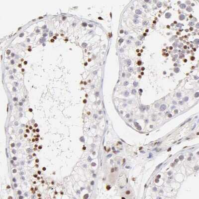 Immunohistochemistry-Paraffin: KLF4 Antibody [NBP1-83940]