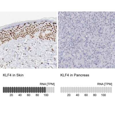 Immunohistochemistry-Paraffin: KLF4 Antibody [NBP1-83940]