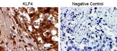 Immunohistochemistry-Paraffin: KLF4 Antibody [NBP2-24749]
