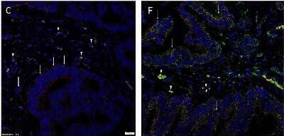 Immunohistochemistry-Paraffin: KLF4 Antibody [NBP2-24749]