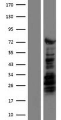 Western Blot: KLF4 Overexpression Lysate [NBP2-10234]