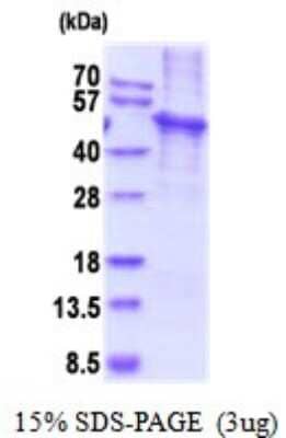 SDS-PAGE: Recombinant Human KLF4 His Protein [NBP2-52014]