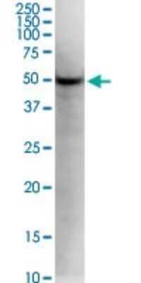 Western Blot: KLF5 Antibody (2G12) [H00000688-M01]