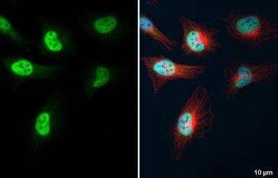 Immunocytochemistry/ Immunofluorescence: KLF5 Antibody [NBP1-32245]