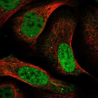 Immunocytochemistry/ Immunofluorescence: KLF5 Antibody [NBP1-88508]