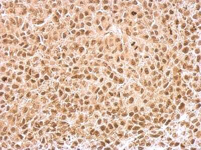 Immunohistochemistry-Paraffin: KLF5 Antibody [NBP1-32245]