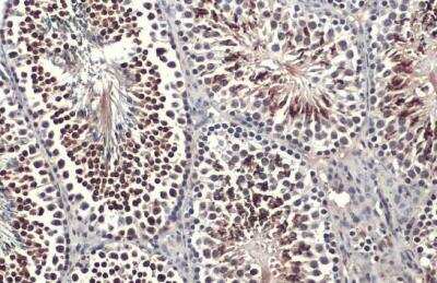 Immunohistochemistry-Paraffin: KLF5 Antibody [NBP1-32245]