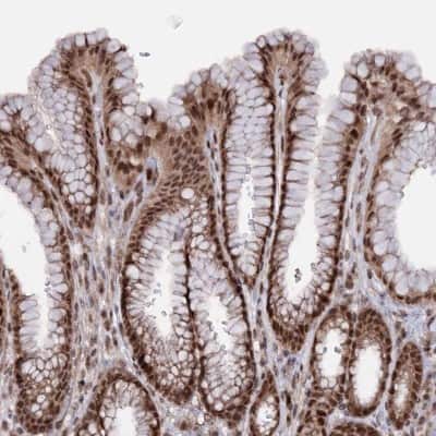 Immunohistochemistry-Paraffin: KLF5 Antibody [NBP1-88508]