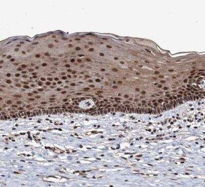 Immunohistochemistry-Paraffin: KLF5 Antibody [NBP1-88508]