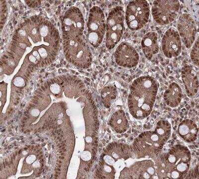 Immunohistochemistry-Paraffin: KLF5 Antibody [NBP1-88508]