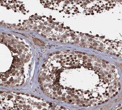 Immunohistochemistry-Paraffin: KLF5 Antibody [NBP1-88508]