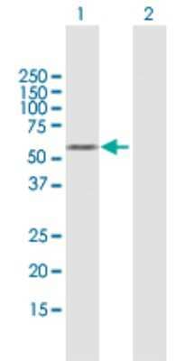 Western Blot: KLF5 Antibody [H00000688-B01P]