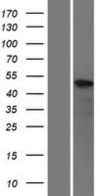 Western Blot: KLF5 Overexpression Lysate [NBP2-08180]