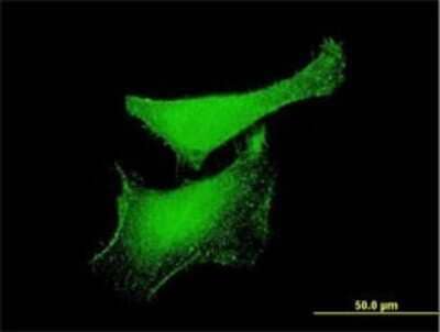 Immunocytochemistry/ Immunofluorescence: KLF6 Antibody (3C4) [H00001316-M02]