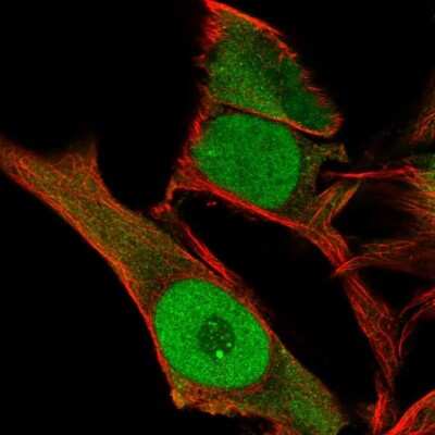 Immunocytochemistry/ Immunofluorescence: KLF6 Antibody [NBP2-57355]