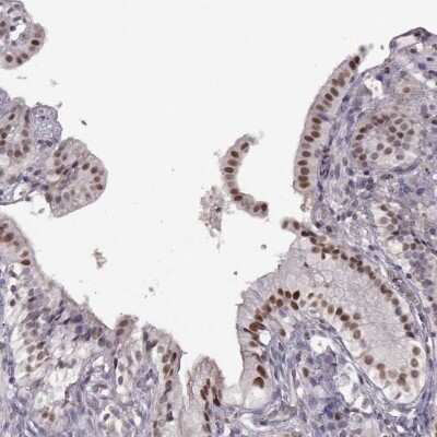 Immunohistochemistry-Paraffin: KLF6 Antibody [NBP2-57355]
