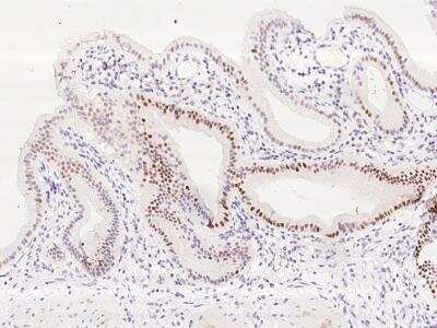 Immunohistochemistry-Paraffin: KLF6 Antibody [NBP3-06200]