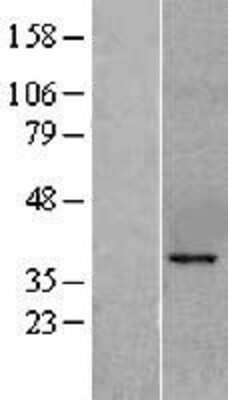 Western Blot: KLF6 Overexpression Lysate [NBL1-12321]