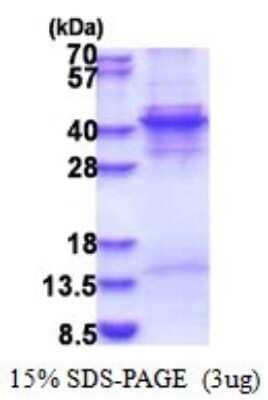 SDS-PAGE: Recombinant Human KLF6 His Protein [NBP2-51565]