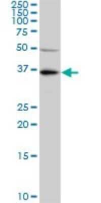 Western Blot: KLF7 Antibody (3E8-B8) [H00008609-M01]