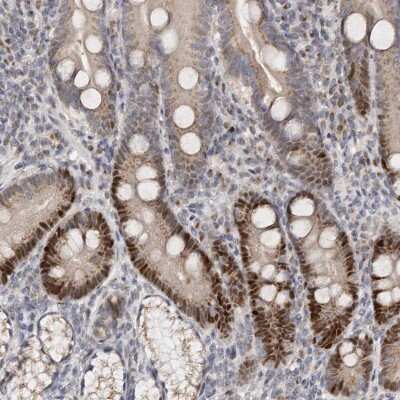 Immunohistochemistry-Paraffin: KLF7 Antibody [NBP1-80638]