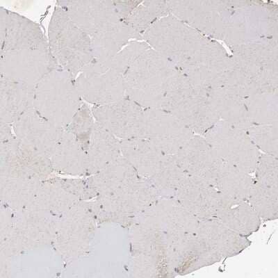 Immunohistochemistry-Paraffin: KLF7 Antibody [NBP1-80638]