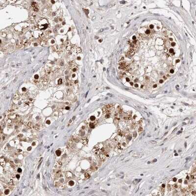 Immunohistochemistry-Paraffin: KLF7 Antibody [NBP1-80638]