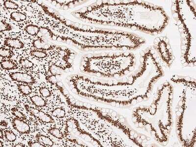 Immunohistochemistry-Paraffin: KLF7 Antibody [NBP2-99217]