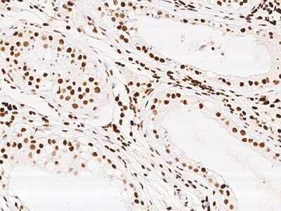 Immunohistochemistry-Paraffin: KLF7 Antibody [NBP2-99217]