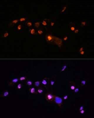 Immunocytochemistry/ Immunofluorescence: KLF8 Antibody - Azide and BSA Free [NBP3-04846]
