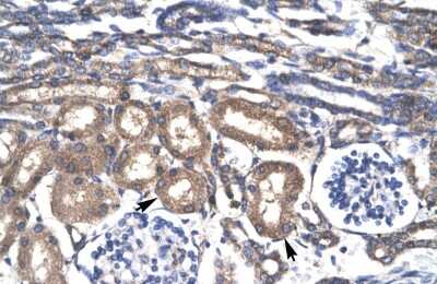 Immunohistochemistry: KLF8 Antibody [NBP2-87696]