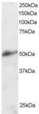 Western Blot: KLF8 Antibody [NB100-1050]