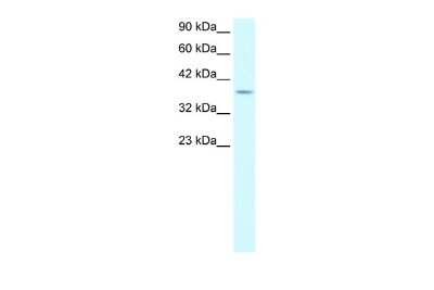 Western Blot: KLF8 Antibody [NBP2-87697]