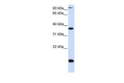 Western Blot: KLF8 Antibody [NBP2-87698]