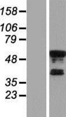 Western Blot: KLF8 Overexpression Lysate [NBP2-07514]