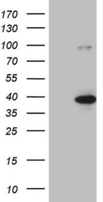 Western Blot: KLF9 Antibody (OTI8A11) [NBP2-45511]